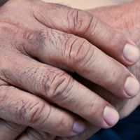 troubled hands